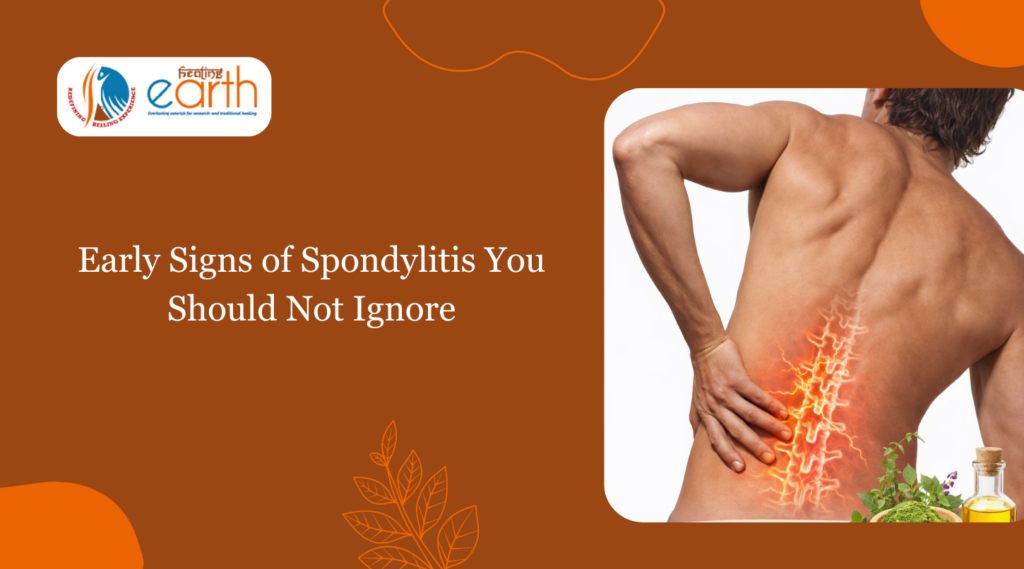 Early Signs of Spondylitis You Should Not Ignore