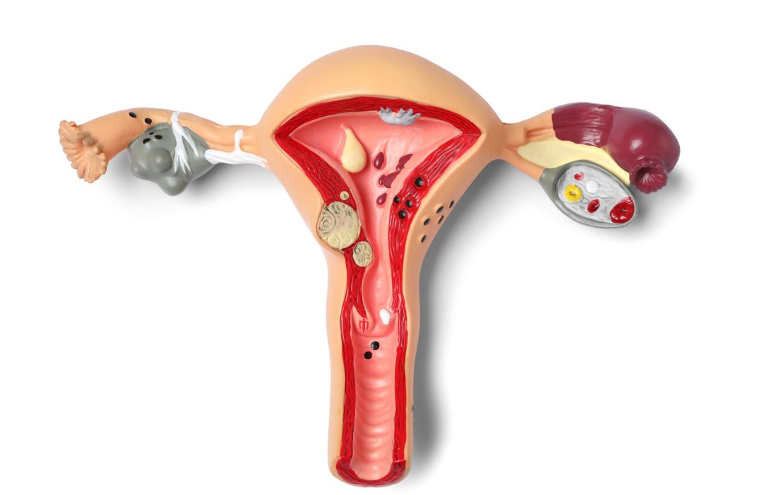 Model of female reproductive system isolated on white, top view. Gynecological care